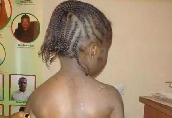 WICKEDNESS: 5-Year-Old Girl Beaten And BITTEN By Her Uncle’s Wife In Kaduna (Photo)